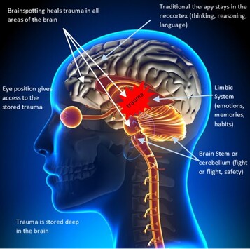 Brainspotting — how trauma in the limbic system and brainstem is accessed through eye position